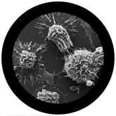 GIANTmicrobes - Cancer (Malignant Neoplasm)